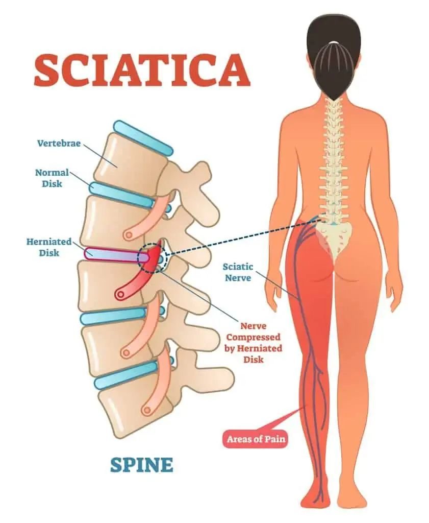 Home physiotherapy services in Bangalore by NearToCare.